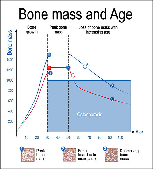 A graph showing how bone mass decreases with age